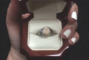 Le propuso casamiento a la novia con un anillo hecho con su muela de juicio