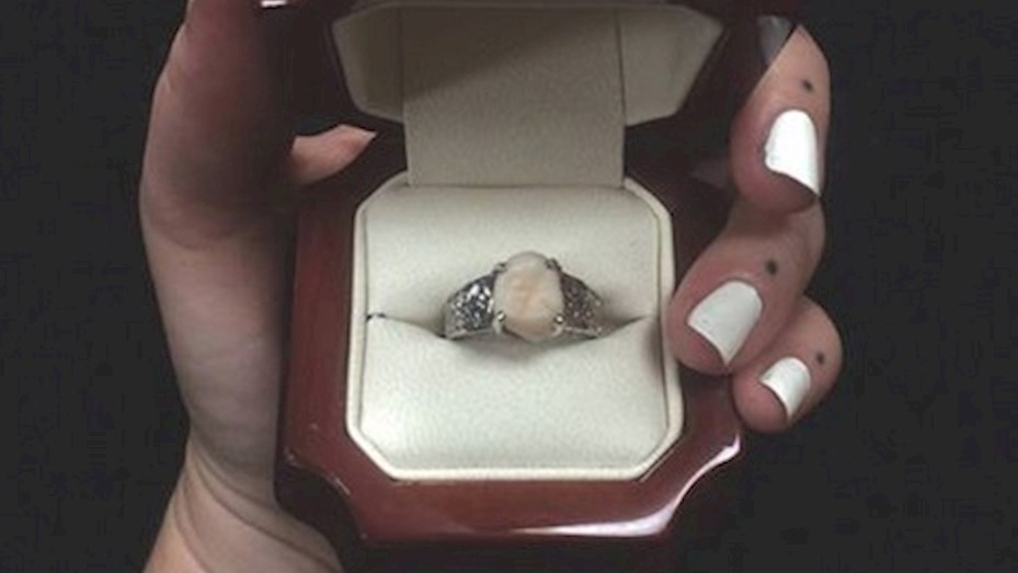 Le propuso casamiento a la novia con un anillo hecho con su muela de juicio