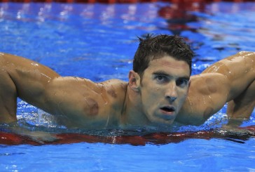 Cupping: cómo es el tratamiento de Michael Phelps