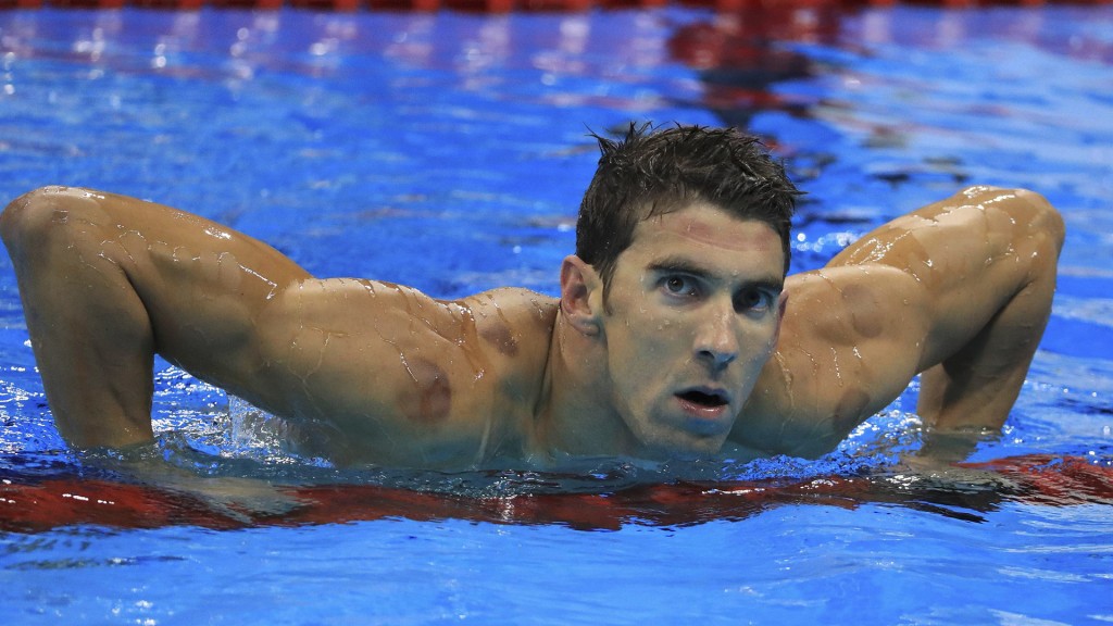 Cupping: cómo es el tratamiento de Michael Phelps