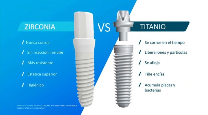 implantes