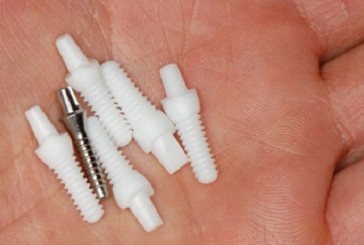 Implantes dentales de zirconia en Argentina