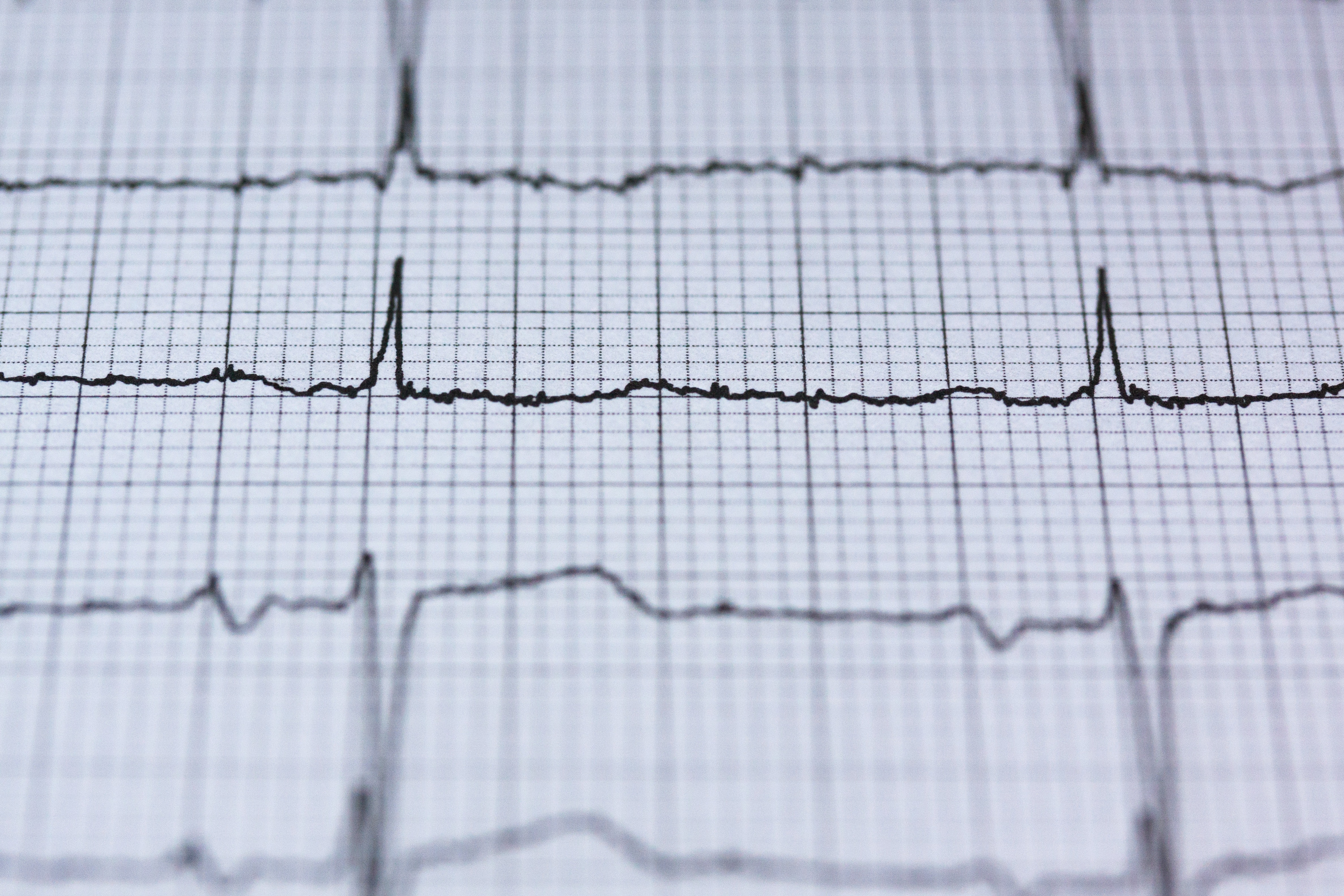 Cuáles son los estudios que ayudan a predecir el riesgo cardiovascular