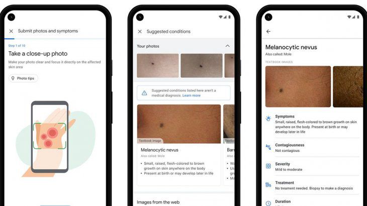 La nueva app de Google para evitar sustos médicos al buscar enfermedades