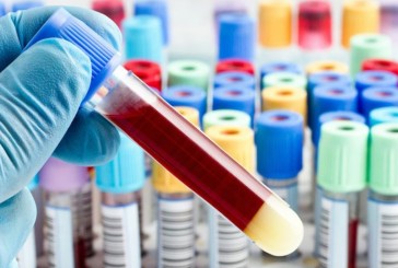 Un nuevo test de sangre permite la detección temprana de 50 tipos de cáncer