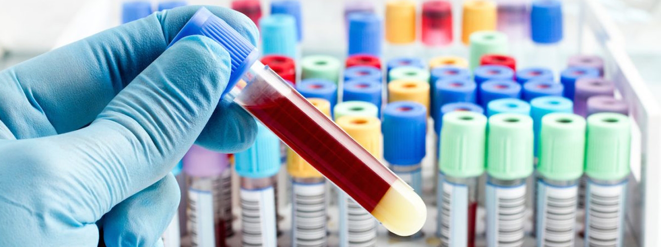 Un nuevo test de sangre permite la detección temprana de 50 tipos de cáncer