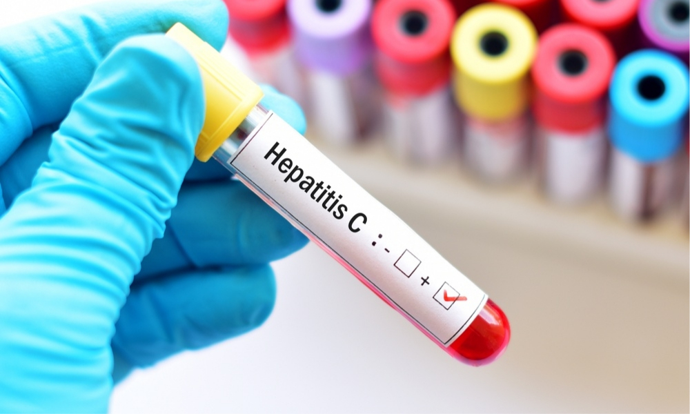 Hallan una pieza clave para el desarrollo de vacunas contra el virus de la hepatitis C